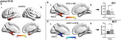 Differential Abnormality in Functional Connectivity Density in Preclinical and Early-Stage Alzheimer's Disease